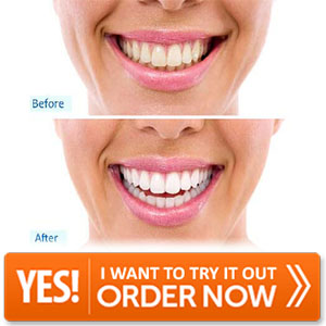 Cleaner Smile Whitening System